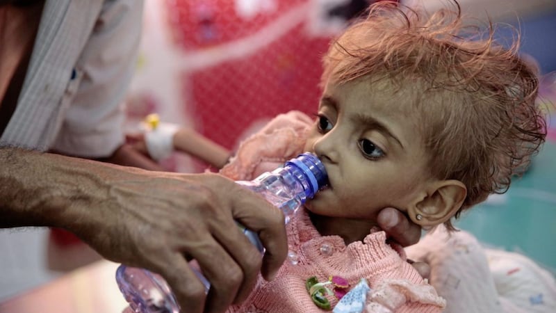 A father gives water to his malnourished daughter at a feeding center in a hospital in Hodeida, Yemen Picture by Hani Mohammed/AP 