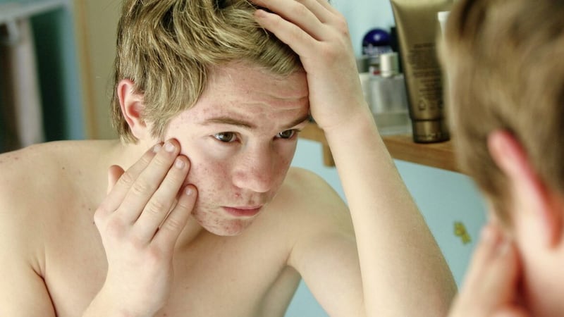 Teenage spots can be painful and may have an emotional impact as well as physical. 