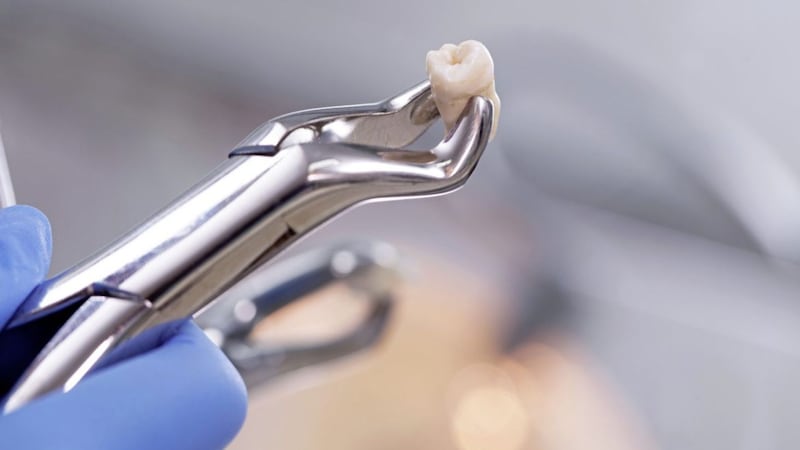 Out you come &ndash; how a tooth socket heals after the tooth has been removed can depend on the blood clotting process 