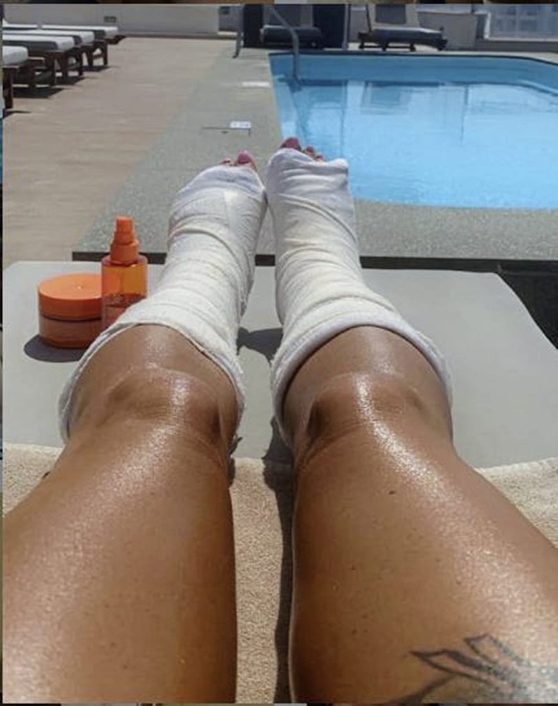 Katie Price captioned this Instagram picture: &quot;Still going to enjoy the sun and create new tan lines&quot;