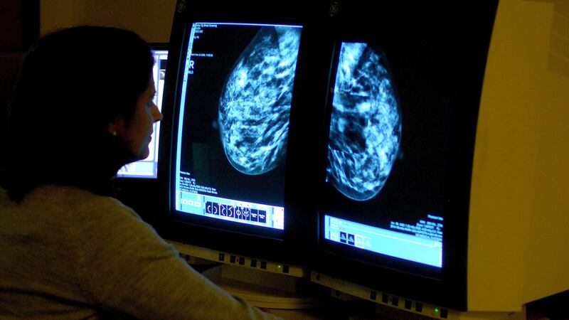 Women diagnosed with breast cancer at a younger age have a higher risk of secondary cancer than older women, according to research.