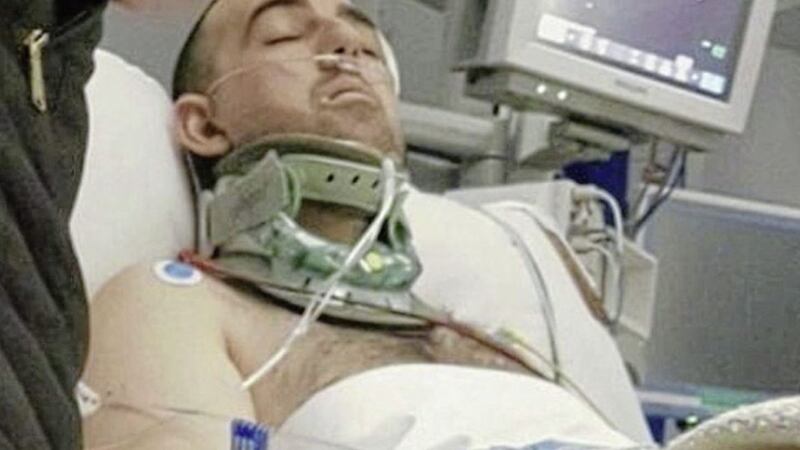 Eddie Devine pictured in hospital shortly after he was seriously injured in a hit and run incident in 2018 