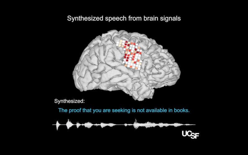 Electrical activity recorded from the brain's speech centres (coloured dots) was used to generate synthesised spoken words