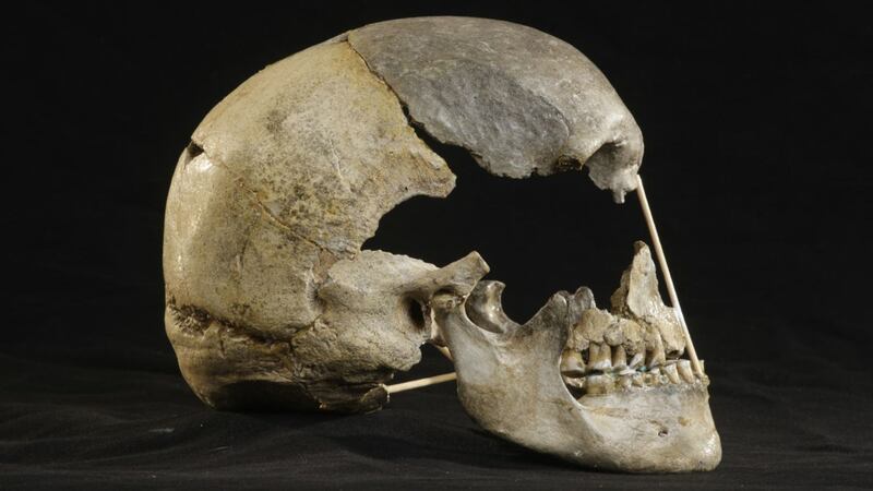 Findings are based on the fossil skull of a woman in the Czech Republic.