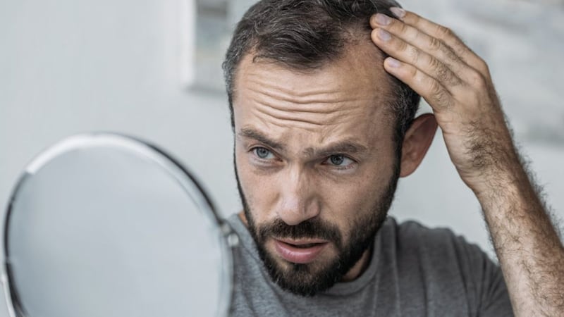 Hair loss can be a source of embarrassment 