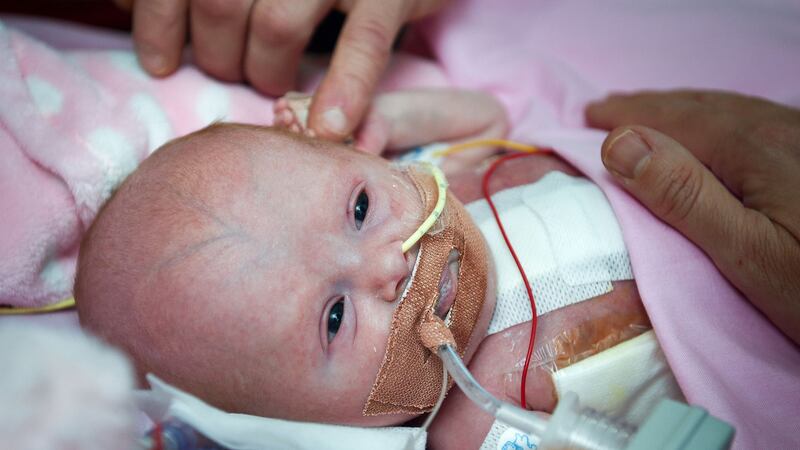 A nine-week scan showed Vanellope Hope Wilkins to suffer from an extremely rare heart condition.