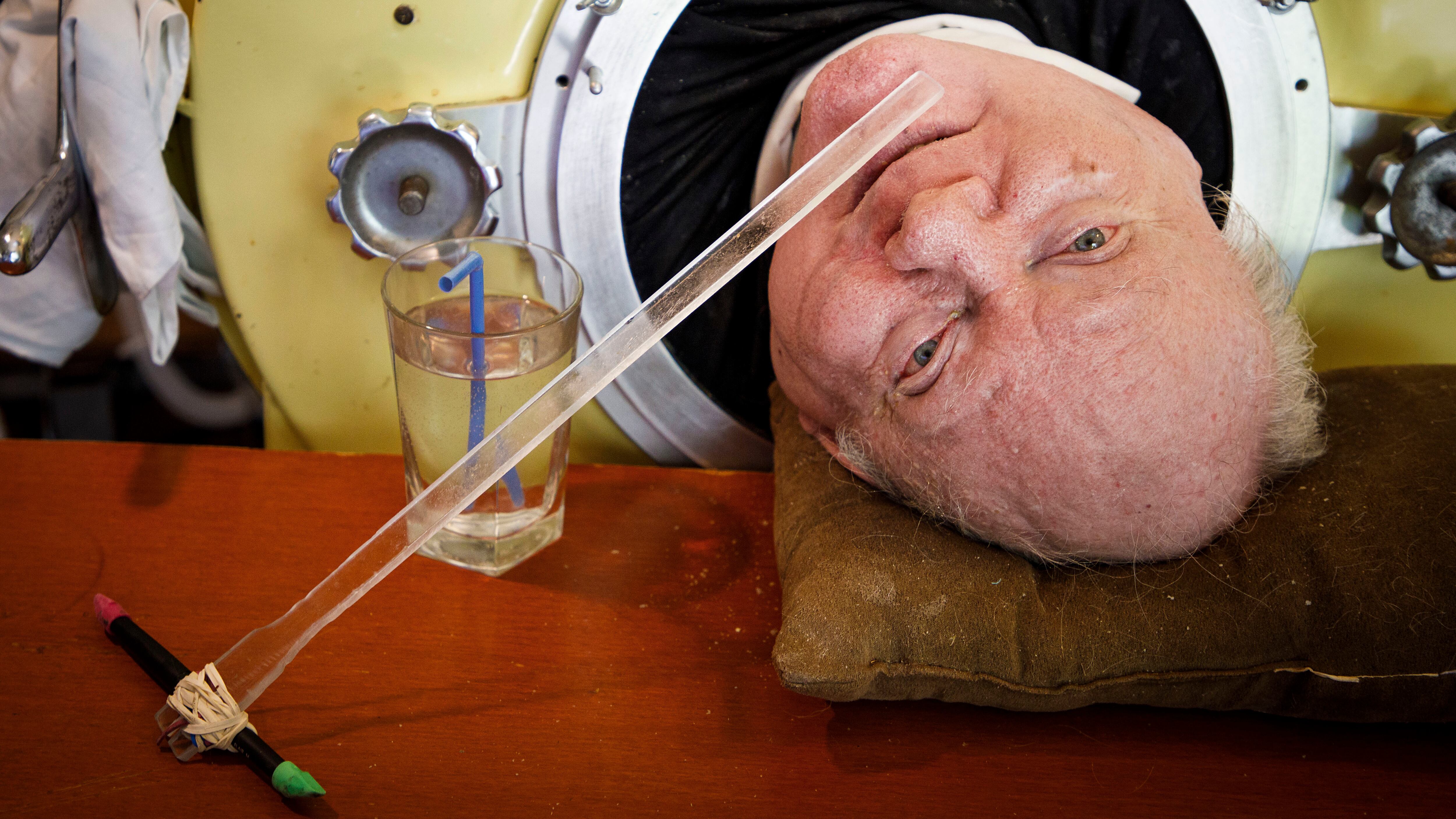 Paul Alexander worked as a lawyer despite being in an iron lung from the age of six (Smiley N. Pool/The Dallas Morning News via AP)