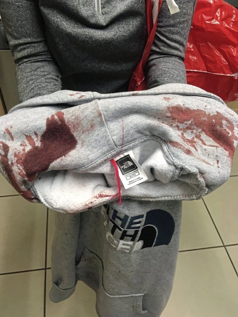 The blood-soaked top Patrick Burns (14) was wearing when he was attacked by four youths in the Deerpark area on Friday evening 