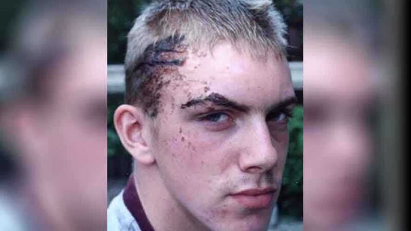 &nbsp;Ciaran Maxwell was the victim of a sectarian attack in Larne in 2002