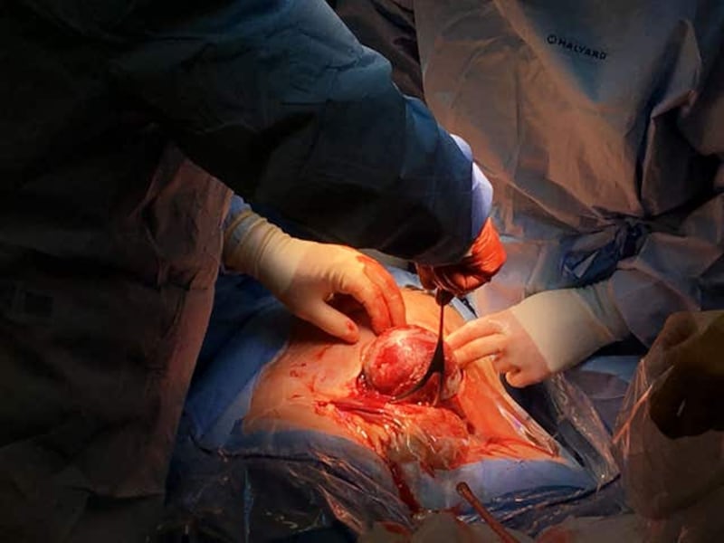 Vanellope Wilkins heart operation