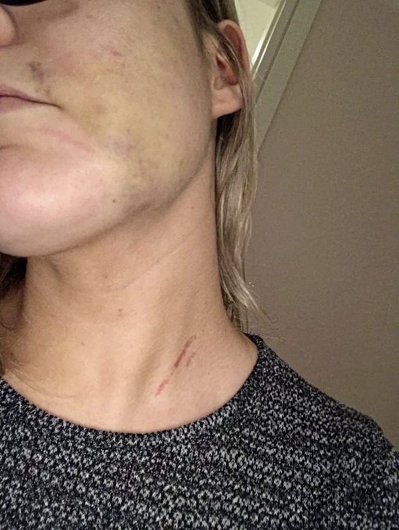 Ciara Hindman was assaulted in her apartment 