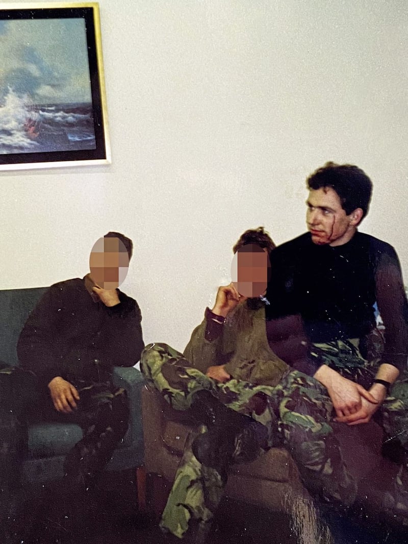 Andrew Rawding injured following a Mk12 mortor attack in Lurgan in 1992. 