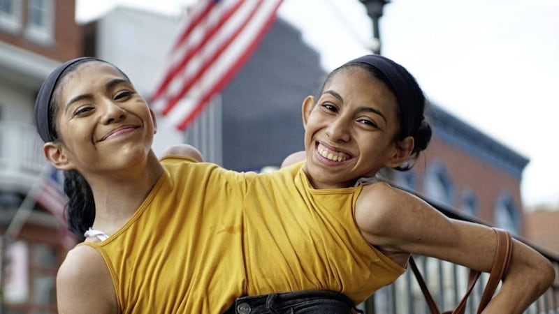 Conjoined twins Carmen and Lupita Andrade. Picture: Channel 4 