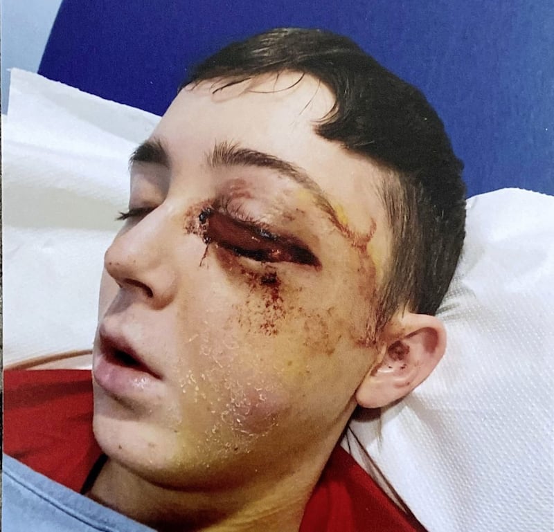 Kyle McPhilips pictured in hospital after being repeatedly punched in the face 