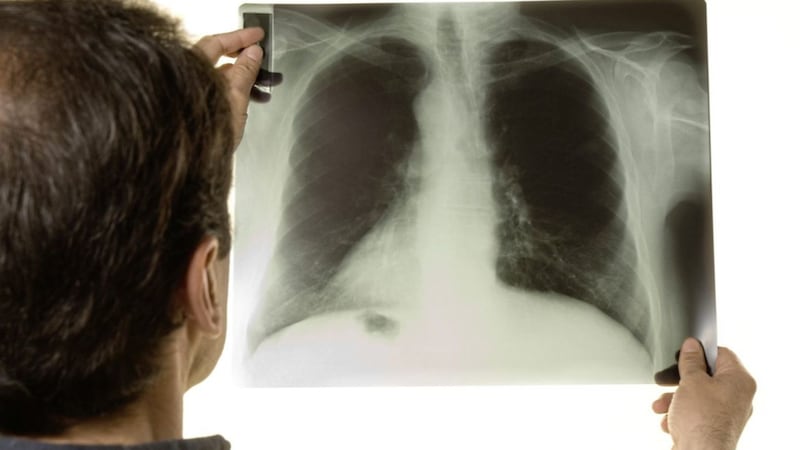 TB is spread through the air and usually affects the lungs 