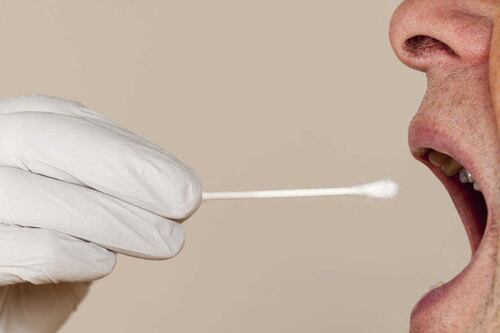 10-minute saliva test for cancer unveiled 