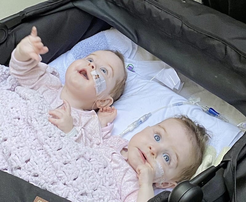 Little Annabelle and Isabelle Bateson, pictured after their surgery last year