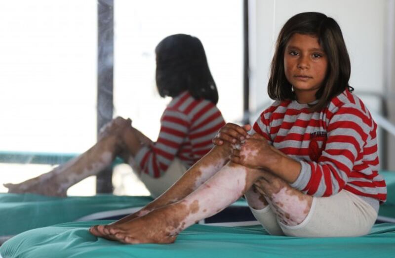Syrian child receives treatement