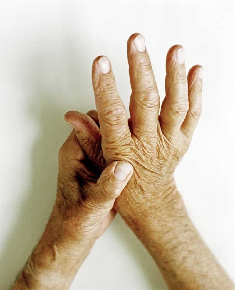 Osteoarthritis can often affect the fingers 