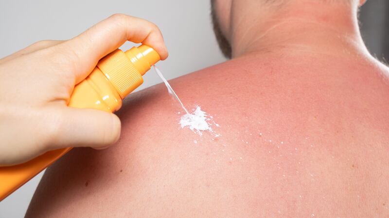 Sun exposure is a big factor in melanoma risk