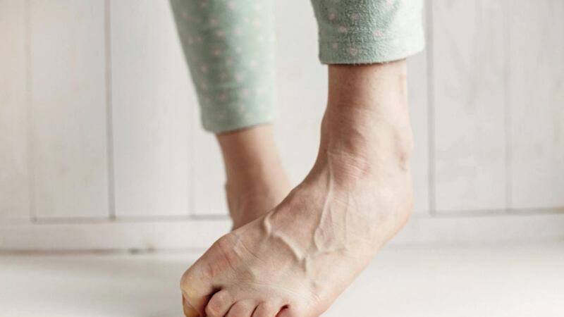 Keeping toes with a fungal infection hidden 100 per cent of the time isn&#39;t always practical 