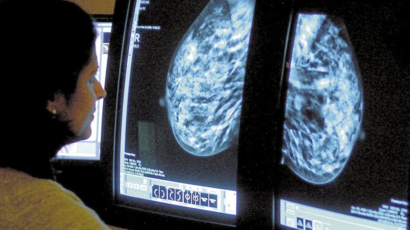 A target for all urgent breast cancer referrals to receive an assessment by a specialist within 14 days was missed in December. Picture by Rui Vieira/PA Wire 