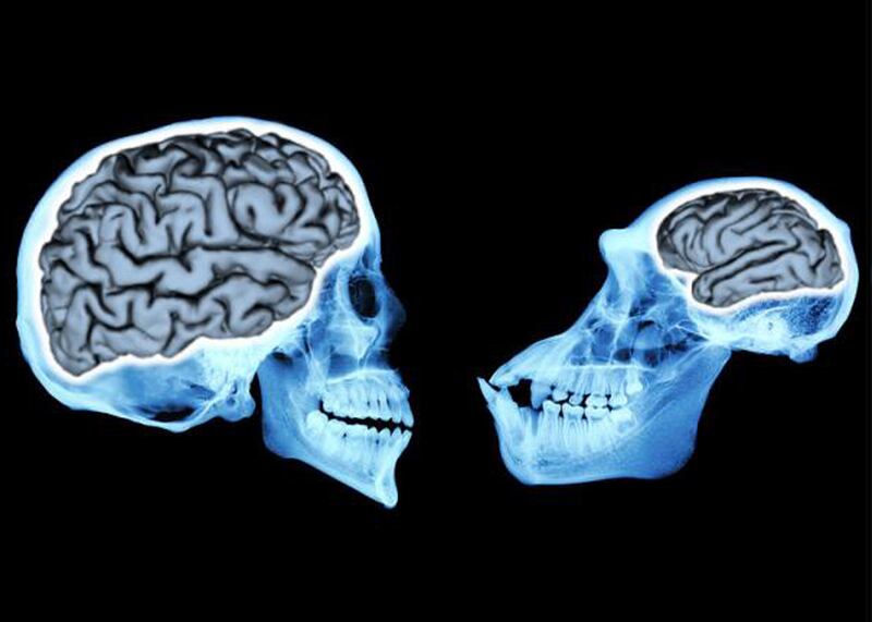 Human and chimpanzee brain.