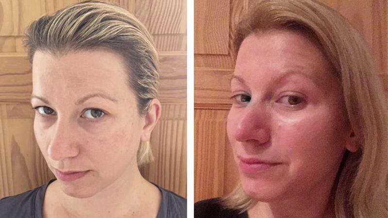 Abi Jackson&#39;s &#39;before&#39; (left) and &#39;after&#39; shots after using Avon ANEW Reversalist Infinite Effects Night Treatment from Avon for one month 