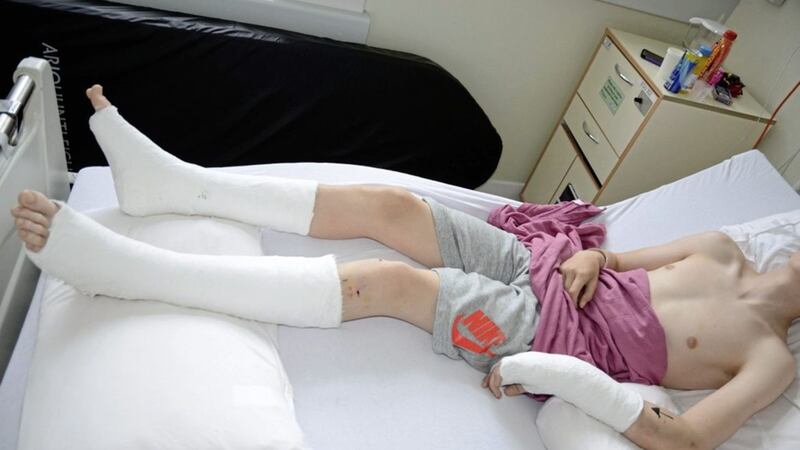 The teenage boy recovers in hospital from his injuries 