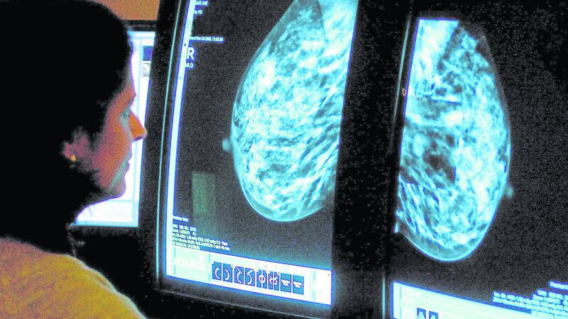 A breast cancer consultant analyses a mammogram  