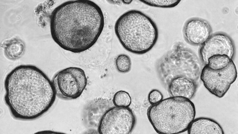 Researchers have developed a new gel from piglet intestinal tissue to grow tissue in the form of organoids.