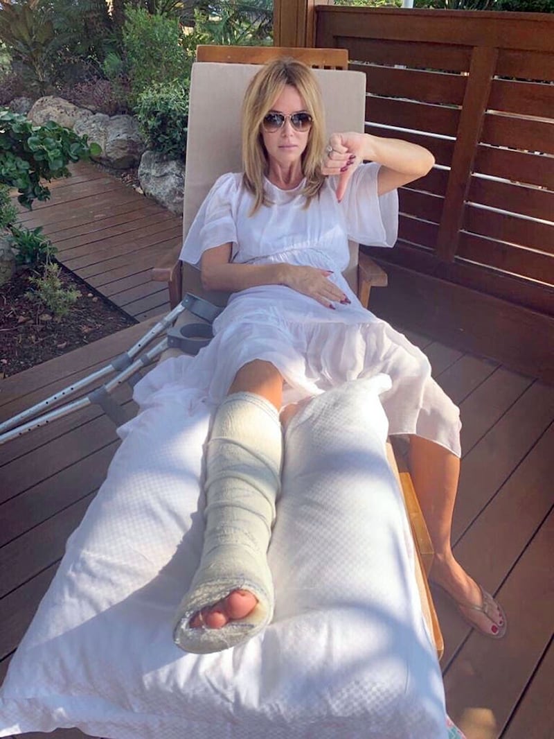 Amanda Holden breaks leg