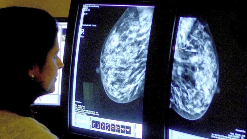 The 14-day target for `urgent referrals&#39; of patients with suspect breast cancer fell to 90 per cent in June, from 94.1 per cent last year, despite 73 fewer referrals overall relating to the disease that month. Picture by Rui Vieira/PA Wire 