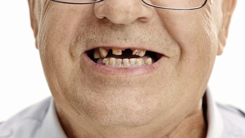 Losing teeth can lead to a dip in self-esteem as the realisation of ageing sparks negative feelings 
