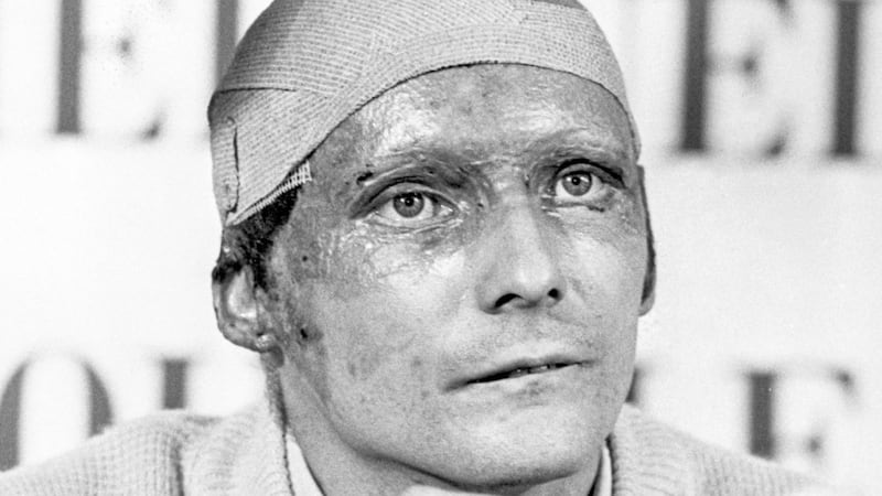 Three-time Formula One champion Niki Lauda, who died this week, fought back from horrific injuries. His influence extended beyond the sport 