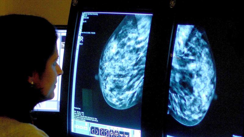 Scientists have found that treating mice with antibiotics could increase the speed of breast cancer growth.
