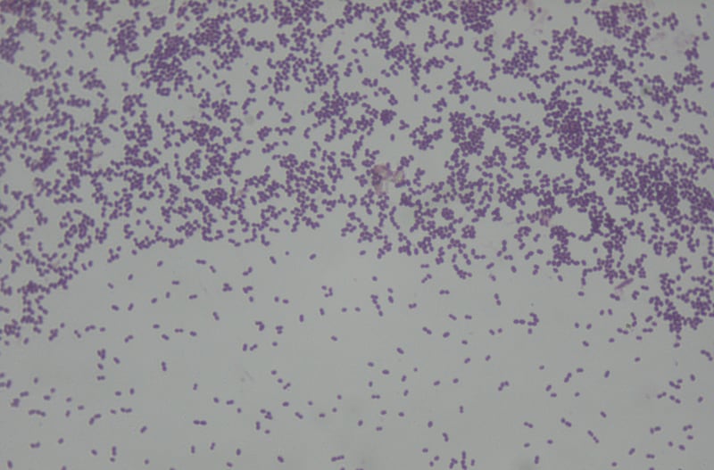 Enterococcus faecalis.