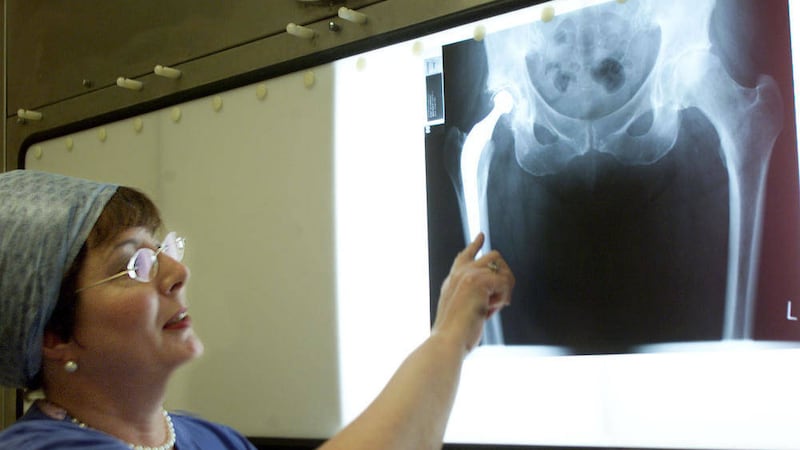 A doctor examines the an patient x-ray following a hip replacement 