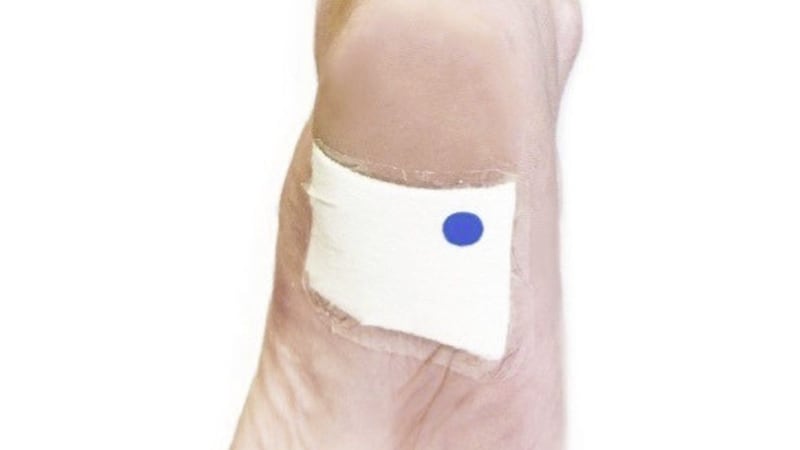 The non-invasive indicator does not make any contact with the wound 