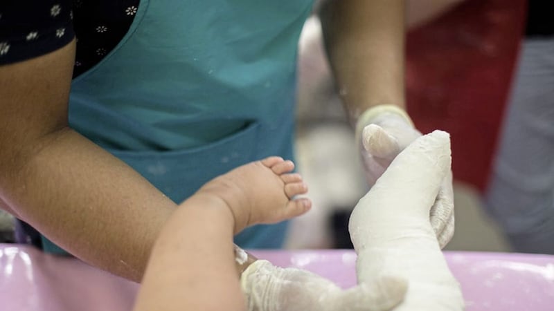 Clubfoot is both common and easily treated 