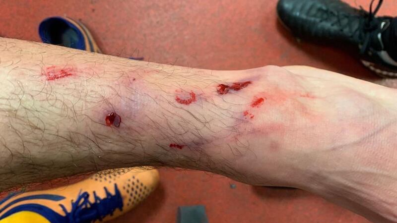 David Buchanan sustained the injury during Northampton Town’s game against Lincoln City.