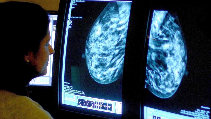 Experts found that early screening led to the detection of more tumours before they had spread.