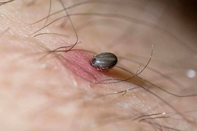 A sheep tick (Ixodes ricinus) feeding on human blood &ndash; Lyme disease can be spread via tick bites 