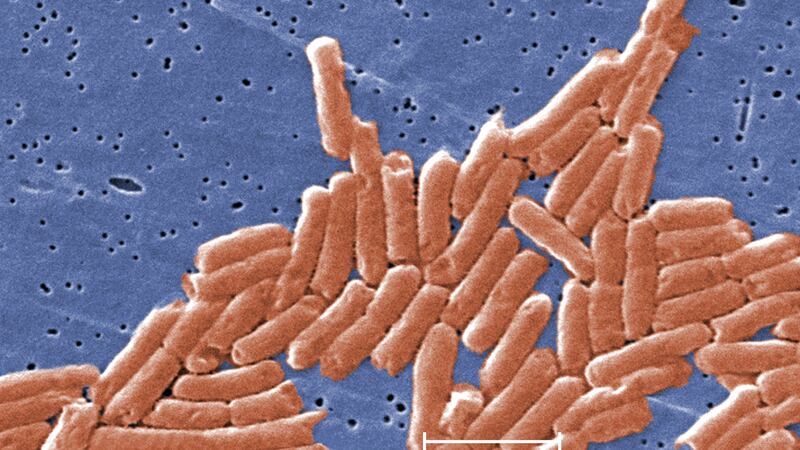 Salmonella is one of the most common causes of food poisoning worldwide.