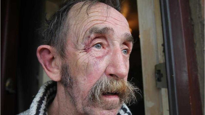 Tommy Crawford was punched around the head by a robber in his Ardoyne home. Picture by Hugh Russell 