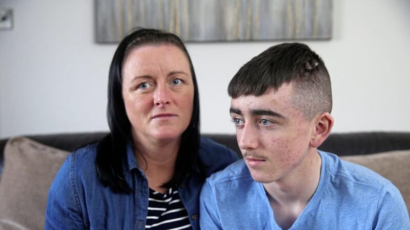 Donna McBride with her son Patrick (14) who was attacked by four youths in the Deerpark area on Friday evening Picture Mal McCann. 