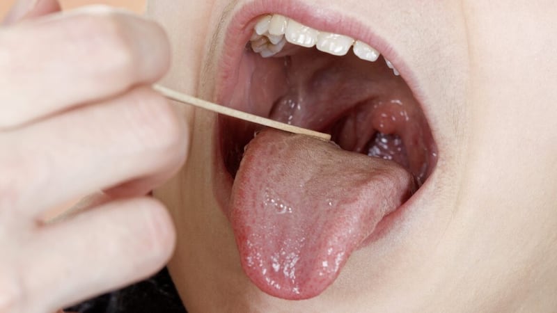 Check your child&#39;s tonsils for signs of trapped food which can cause odours 