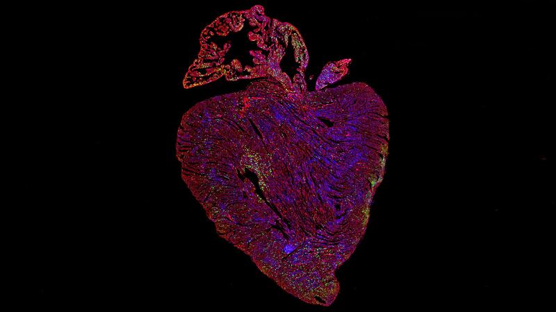A study on mice found that making Myc overactive can trigger the regeneration of heart cells.