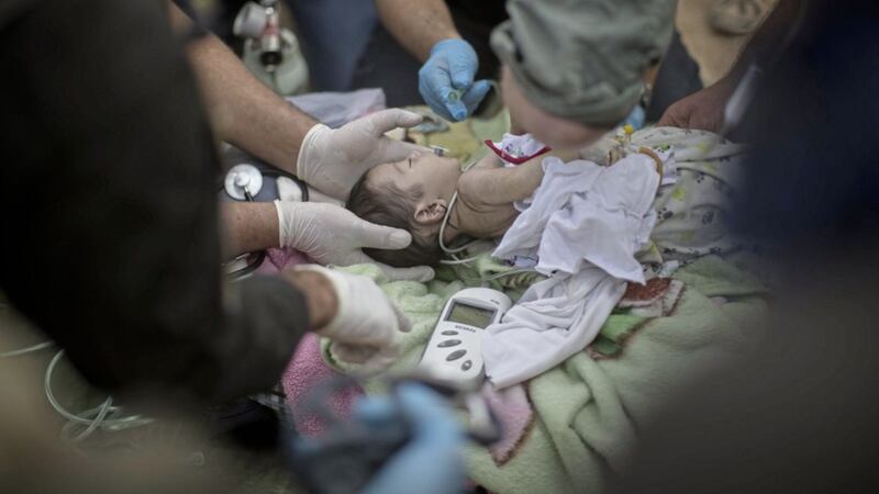 A baby injured during fighting between the Iraqi forces and Islamic State militants is treated at a field hospital in eastern Mosul, Iraq. Picture by Felipe Dana, Associated Press