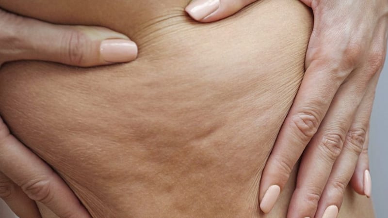 Cellulite are bulging fat cells between fibrous tissue that look like dimples on your skin 